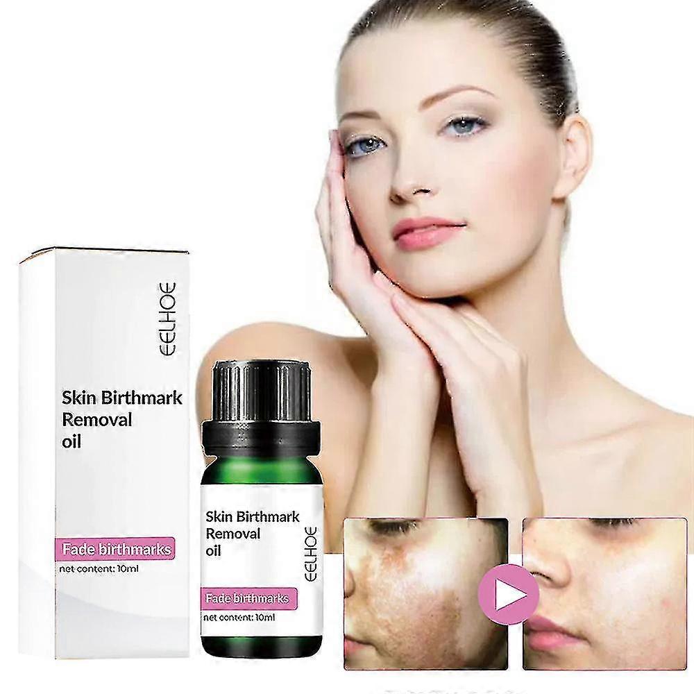 Birthmark Removal Oil 10ML (Pack of 2)