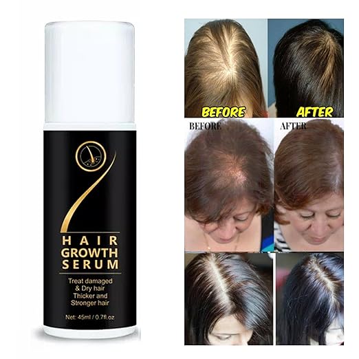 Hair Growth Serum & Treat Damaged & Dry Hair Thicker and Stronger Hair