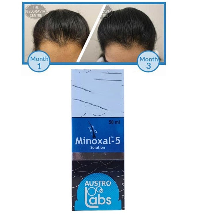 Austro Labs Minoxal Solution, for Hair Growth 60ml Pack of - 1